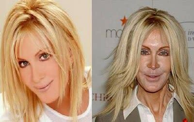 Hollywood Celebrities with Plastic Surgeries