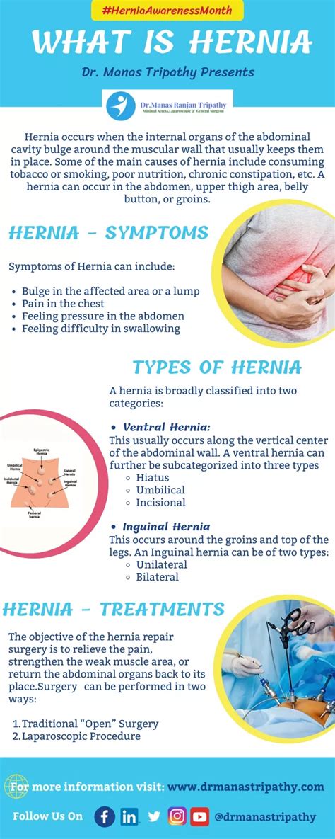 PPT What Is Hernia Hernia Treatment In Bangalore HSR Layout