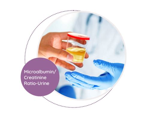 Microalbumin Creatinine Ratio Urine Mediscan Lab