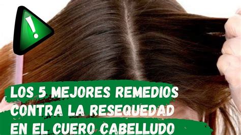 👩 Remedios Para La Resequedad Del Cuero Cabelludo ¿resequedad En El