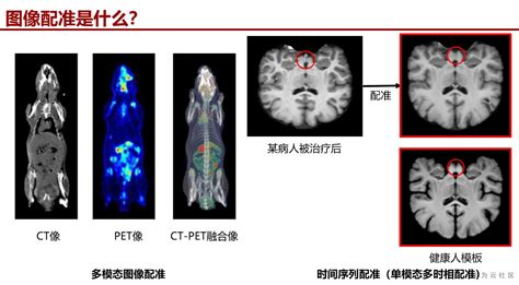 医学图像配准概览和深度学习图像配准前沿热点论文voxelmorph柔性配准 Csdn博客