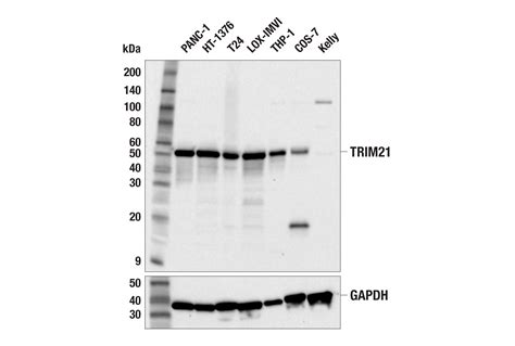 Trim21 F6k7j Rabbit Mab Cell Signaling Technology