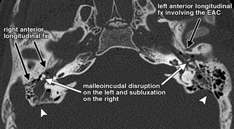 Interactive Web Based Learning Module On Ct Of The Temporal Bone