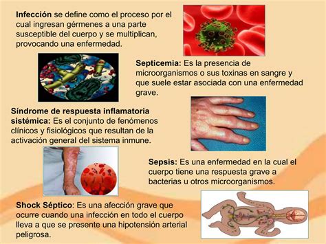 Sepsis Shock Septico PPT