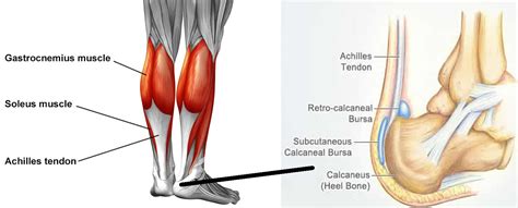 Achilles Tendinitis Causes Symptoms Diagnosis Prognosis Treatment