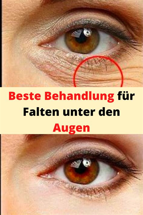 Elegant Falten Unter Den Augen