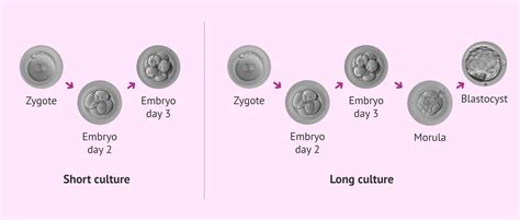 Embryo culture in the in vitro fertilization laboratory (IVF)