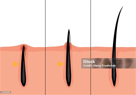 정상와 감아 머리 벡터 일러스트 모낭에 대한 스톡 벡터 아트 및 기타 이미지 모낭 건강관리와 의술 건강한 생활방식