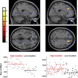 Regional Cerebral Blood Flow Rcbf Differences In The Medial