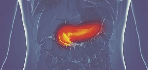 Akute Pankreatitis Bei wem kehrt sie zurück