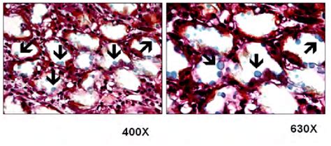 Histological Images Goldner Trichrome Stain Of The Distracted Gap Of