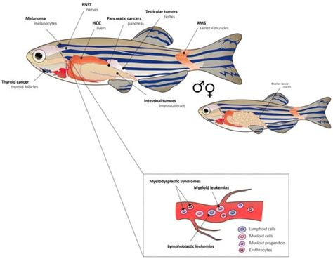 Genes Free Full Text Zebrafish Models Of Cancer—new Insights On