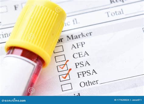 Blood Sample Tube For PSA And Free PSA Test Stock Photo Image Of