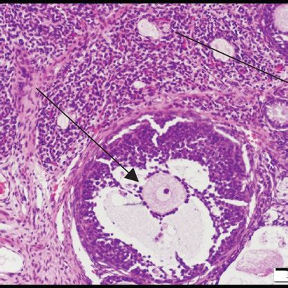 Photomicrographs Of Ovarian Sections Stained With Hematoxylin And