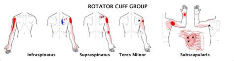 Rotator cuff and shoulder pain - Physiosteps