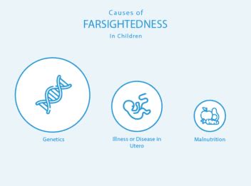 Farsightedness in Children: Causes, Diagnosis & Treatments – NVISION