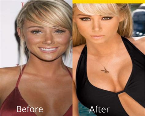 SARA JEAN UNDERWOOD PLASTIC SURGERY | Plastic Surgery Magazine