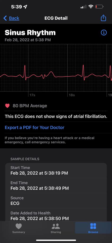 Heart Palpitation Issue : r/medical
