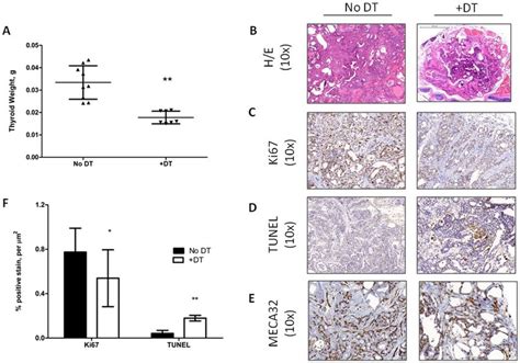 PTC Regression Following Treatment With DT In Tg Braf Ccr2 DTR Mice A