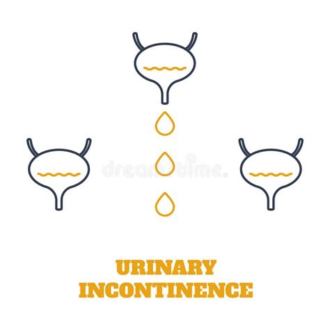 Urinary Incontinence Bladder Disease Awareness Medical Diagram Stock