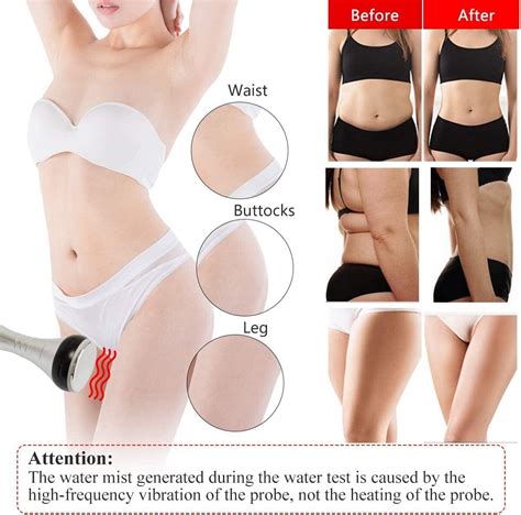 Body Slimming Cavitation Machine - Lush Fills - Buy Dermal Fillers Online