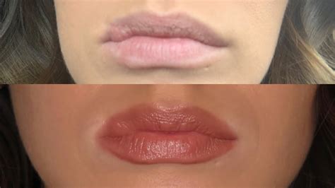 How To Make Scars On Lips Go Away Lipstutorial Org