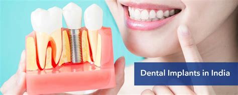 Dental Implants Cost In India Permanent Tooth Implant Cost In India