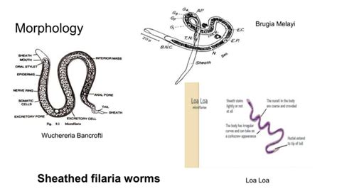 Filariasis Ppt