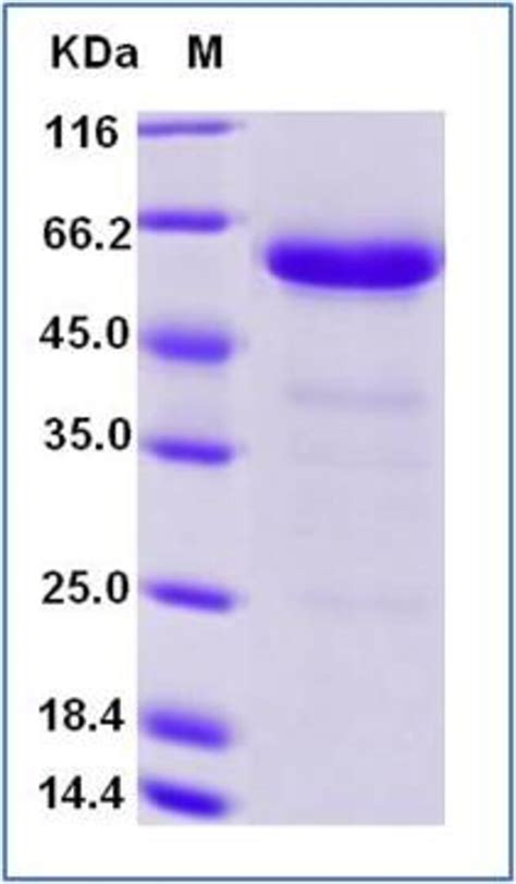 Sino Biological Human FGL1 Protein MFc Tag 1mg Quantity Each Of 1