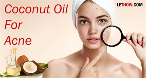 Coconut Oil For Acne