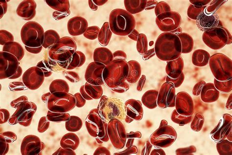 Polycythemia Vera A Rare Slow Growing Blood Cancer With An Increase In