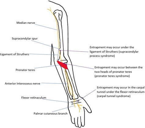 median nerve entrapment syndromes | pacs