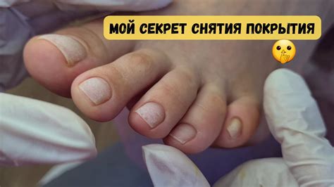 КУТИКУЛУ НЕ СРЕЗАЮ! Аппаратный педикюр с покрытием гель-лаком, педикюр ...