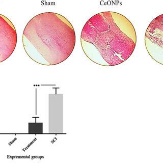 Histological Staining H E Of Longitudinal Sections Of The Spinal Cord