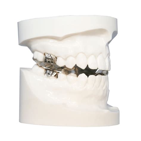 Class Ii Appliances Five Star Orthodontic