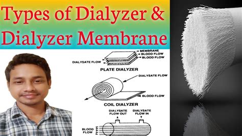 DIALYZER | Types of Dialyzer and Dialyzer membrane | Dialyzer Membrane ...