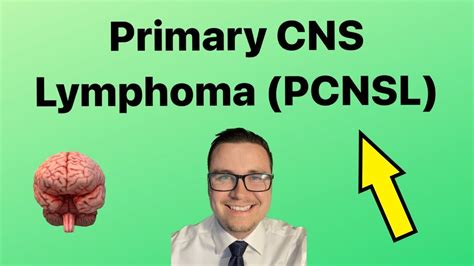 Primary Cns Lymphoma Basics Youtube