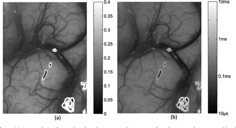 Figure 3 From Laser Speckle Contrast Imaging Of Cerebral Blood Flow In