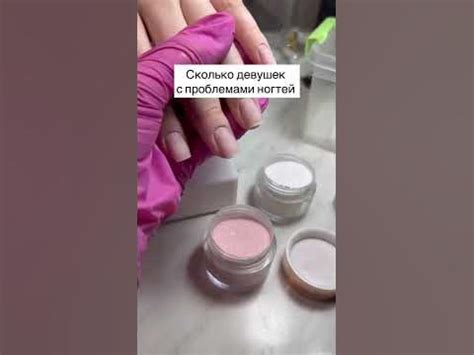 проблемные ногти / онихолизис / титановое покрытие / дип система ...