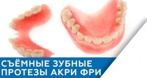Зубные протезы Акри Фри | Acry-Free | «Премьера»