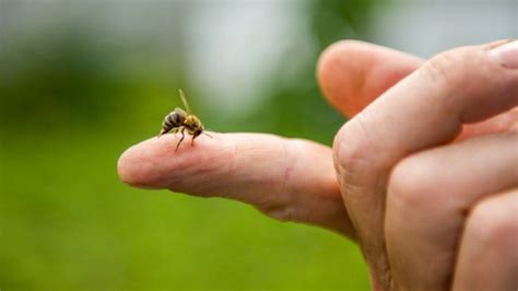 First Aid For Bee Stings Vital First Aid Training Services