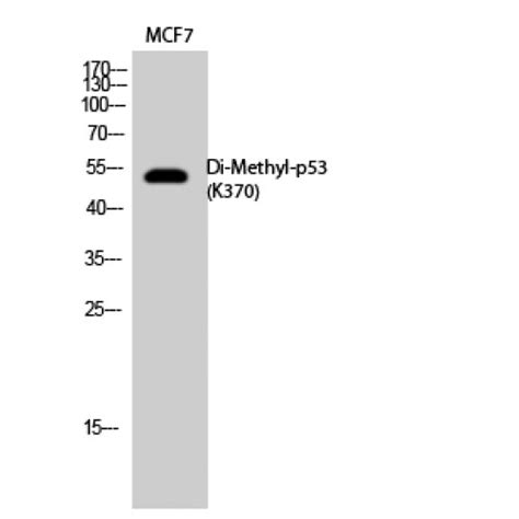 Anti TP53 P53 Antibody Rabbit Anti Human Polyclonal LSBio