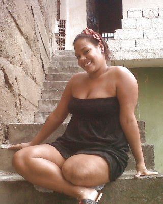 Amputee Girls Are So Sexy Porn Pictures XXX Photos Sex Images