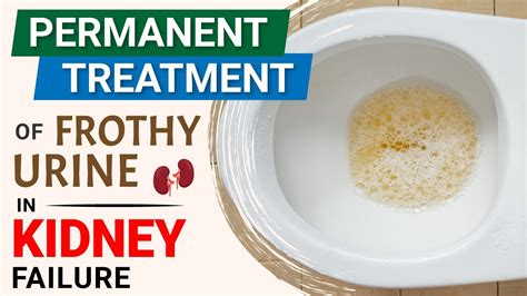 foamy urine kidney disease  kristian christenson blog