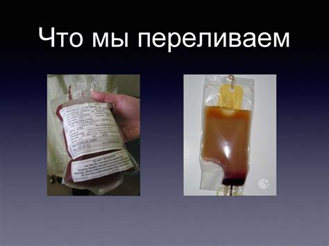 Трансфузионная терапия - online presentation