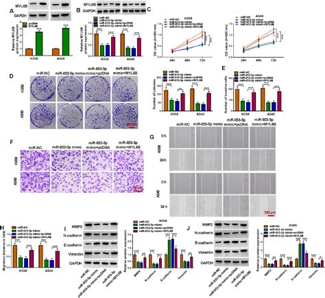 Circ Promotes The Progression And Emt Of Non Small Cell Lung