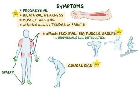 Myositis Symptoms Causes And Treatment Santripty