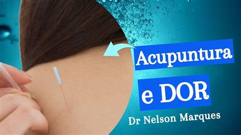 Acupuntura Tratamento Da Dor Dr Prof Nelson Marques YouTube