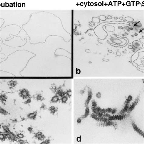 Electron Micrographs Demonstrating The Effects Of Various Incubations