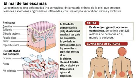 El Magazin De Merlo Excelente Noticia Nuevos Hallazgos Sobre El